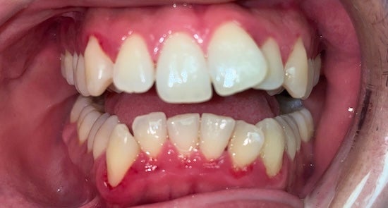 Before