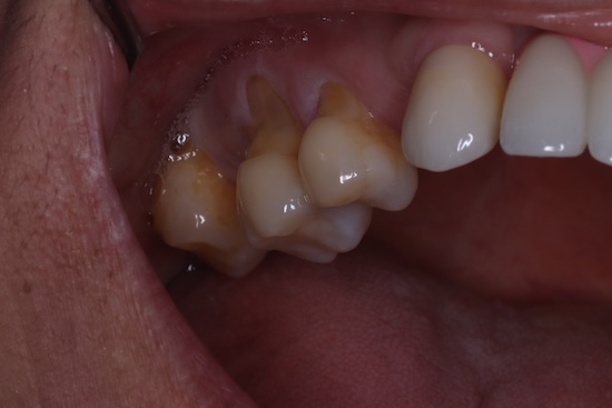 Before