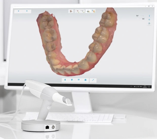 3D Cone Beam and 3D Dental Scans
