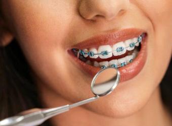 Your Guide to a Perfect Smile with Traditional Braces