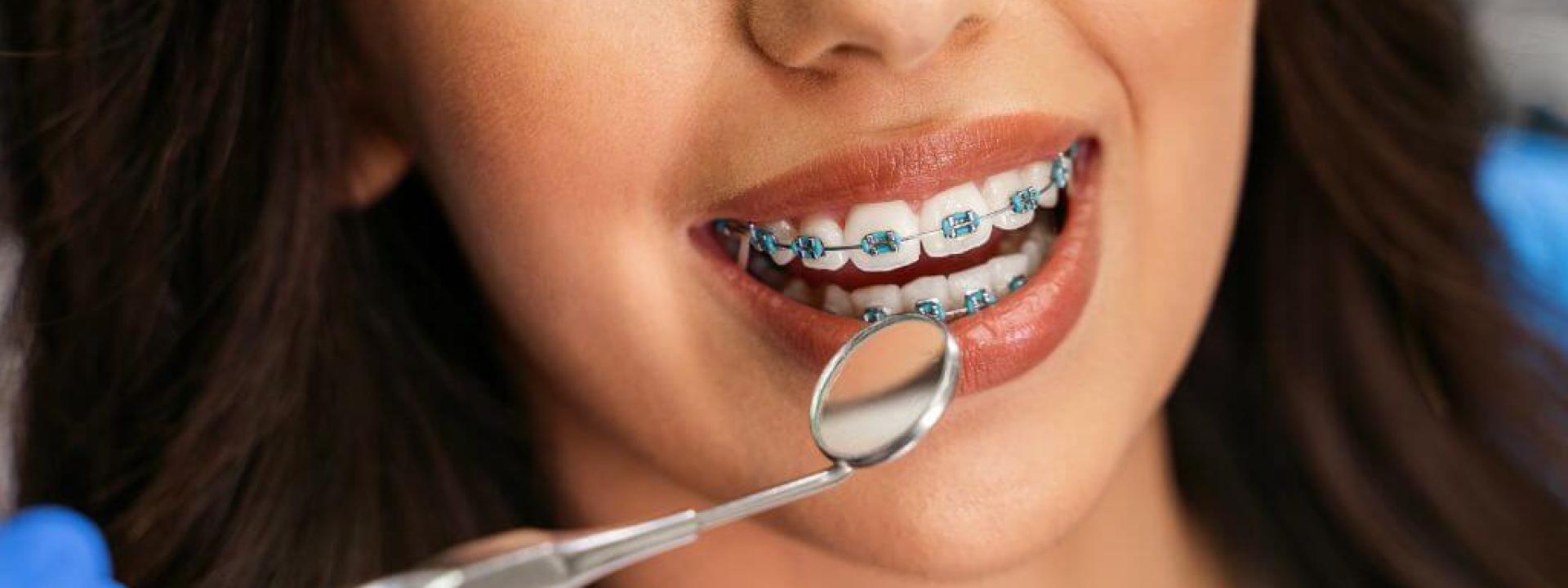 Woman with metal braces