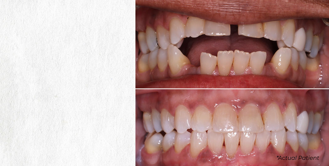 Affordable Dental Care